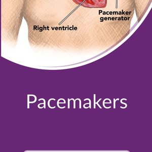 Pacemakers