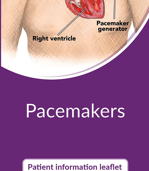 Pacemaker