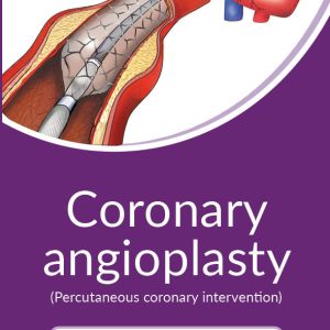 Coronary Angioplasty