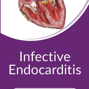 Infective Endocarditis