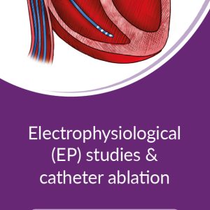 EP Studies & Catheter Ablation
