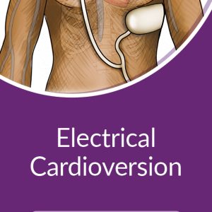 Electrical Cardioversion